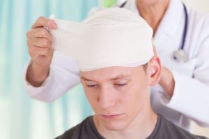 Birmingham Lawyer for Traumatic Brain Injury After a Car Accident