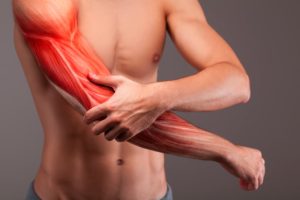 muscle strain arm
